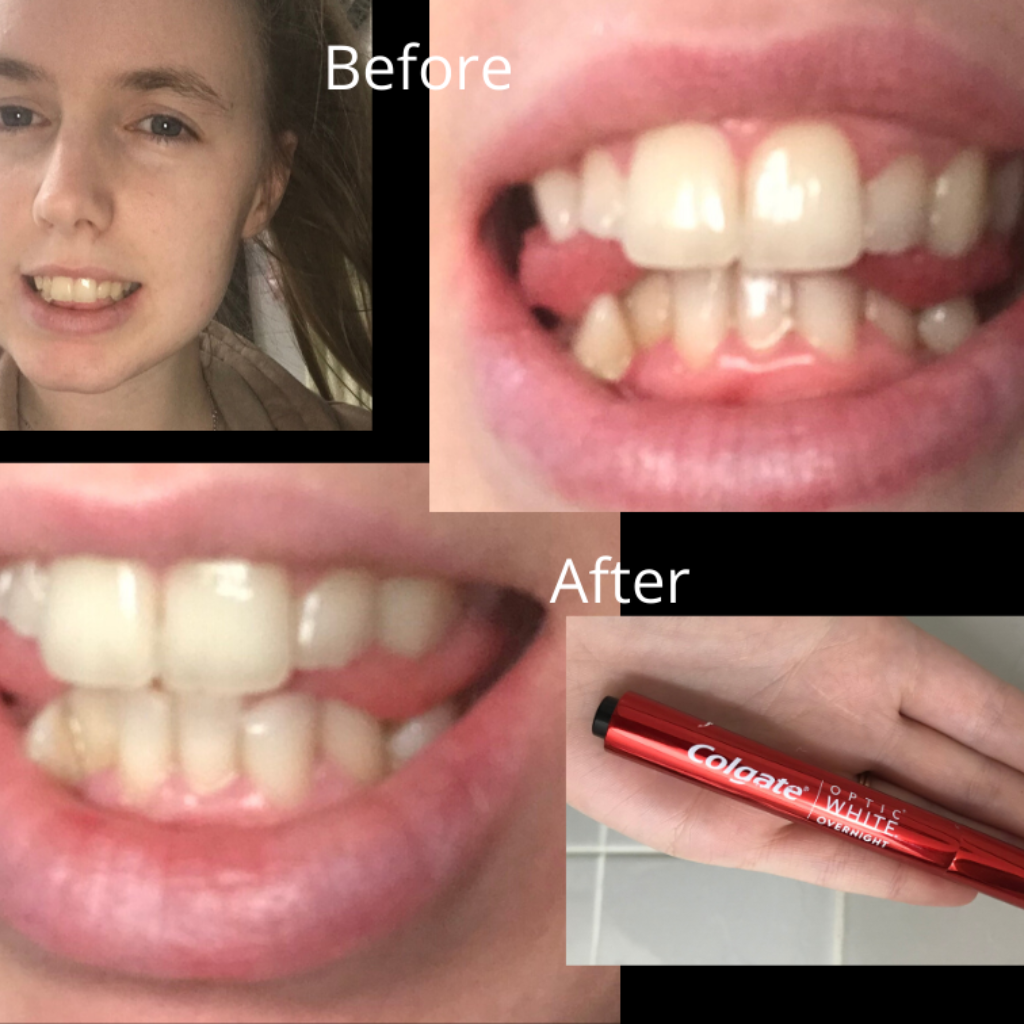 Colgate Max Max White Optic White Overnight Review Optic White