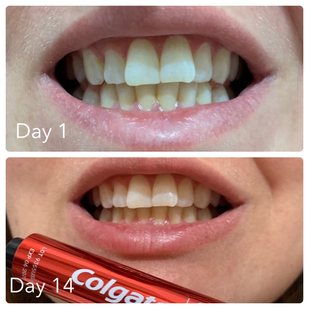 Whiten Teeth Optic White Overnight Review Pen Review Colgate Optic